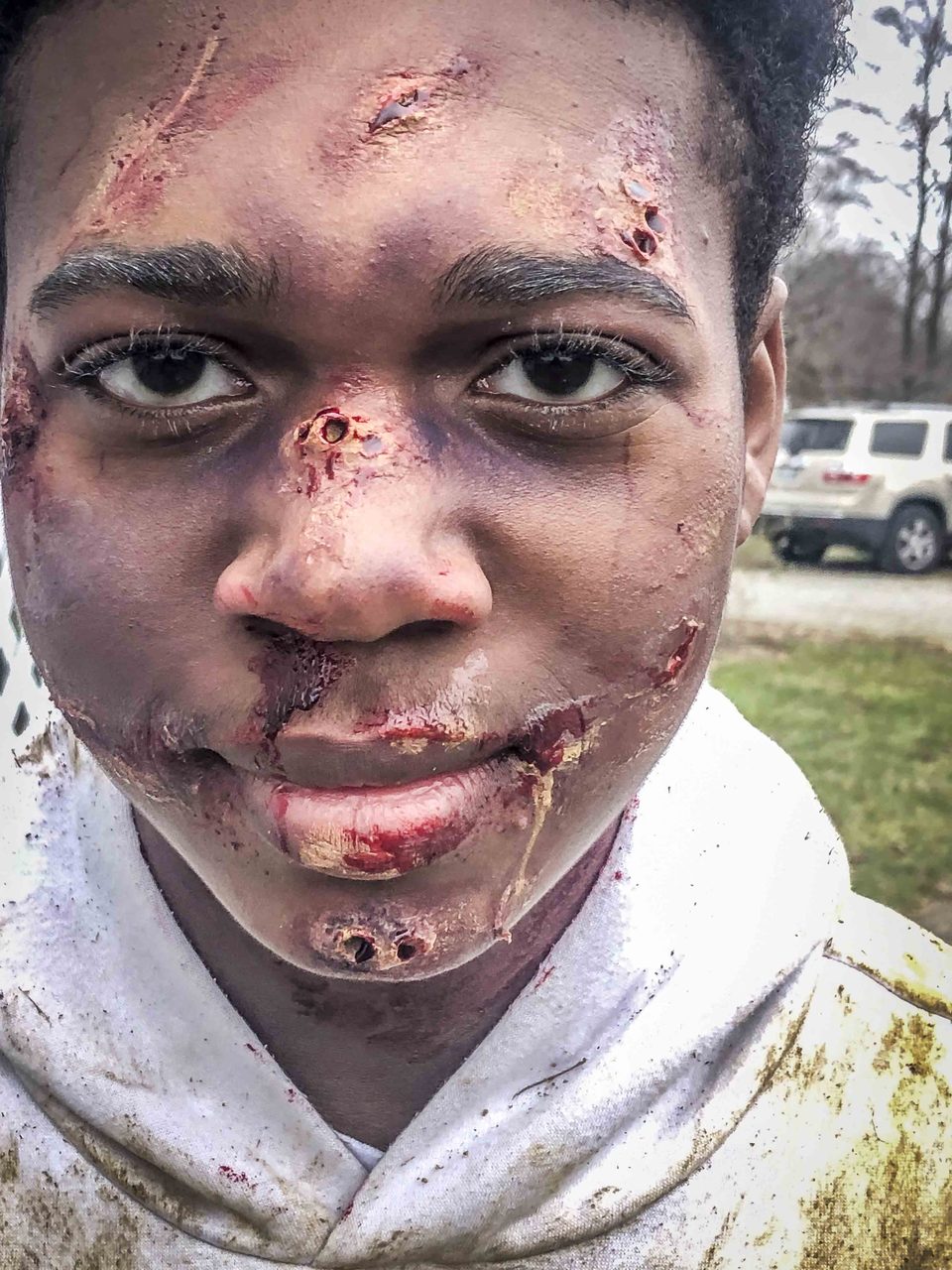An actor shows off special-effects makeup outdoors between takes.